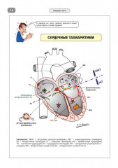Имплантируемые кардиовертеры-дефибрилляторы. Иллюстрированное пошаговое руководство - Фото 10