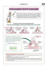 Имплантируемые кардиовертеры-дефибрилляторы. Иллюстрированное пошаговое руководство - Фото 11