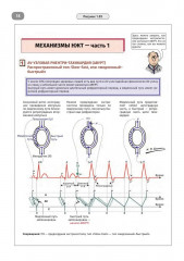 Имплантируемые кардиовертеры-дефибрилляторы. Иллюстрированное пошаговое руководство - Фото 12