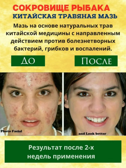 Мазь для лечения кожных заболеваний «Сокровище рыбака»