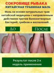 Мазь для лечения кожных заболеваний «Сокровище рыбака» - Фото 3