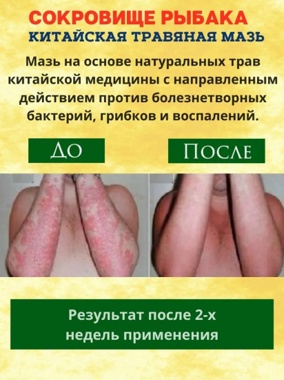 Мазь для лечения кожных заболеваний «Сокровище рыбака»