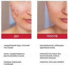 Тонер для лица с галактомисисом и витаминным комплексом «Galac Whitening Vita Toner» - Фото 3