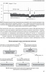 Синкопальные состояния. Практические аспекты - Фото 3