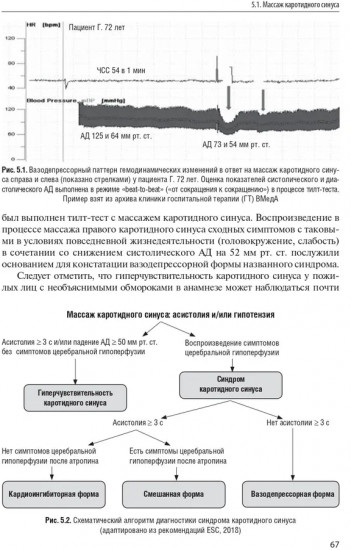 Синкопальные состояния. Практические аспекты