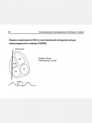 Ультразвуковое исследование в таблицах и схемах - Фото 4