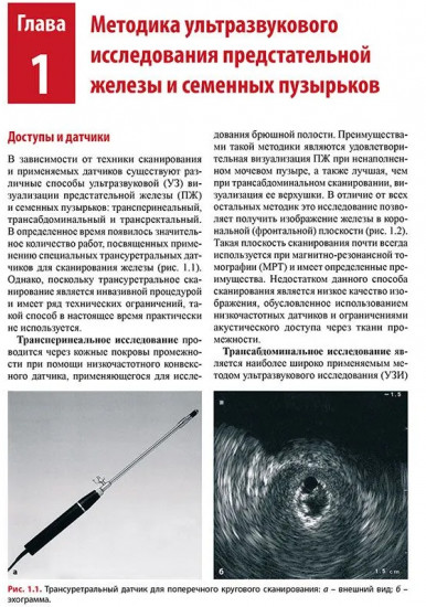 Ультразвуковое исследование предстательной железы