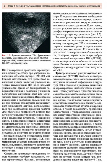 Ультразвуковое исследование предстательной железы