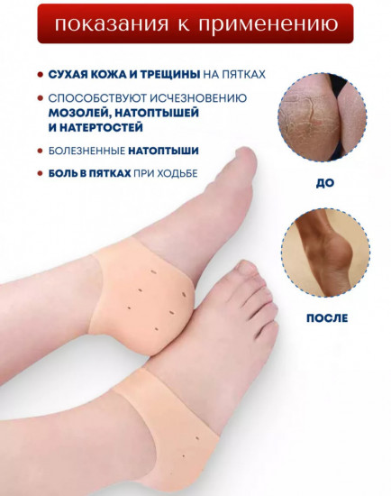Силиконовые носочки для пяток