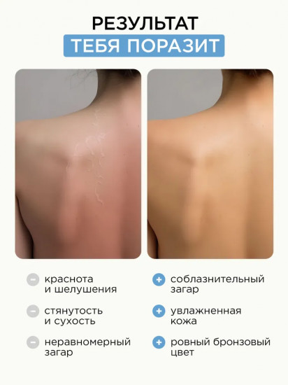 Крем после загара для лица и тела «Moisturizing Body & Face Cream»