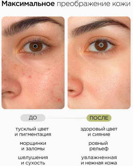Крем для лица увлажняющий «Vitamin C Face Cream»