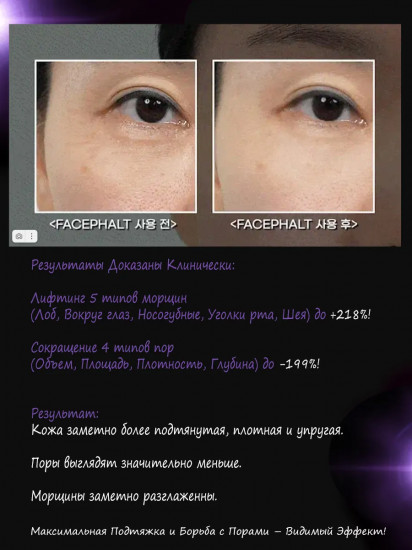 Крем для лица антивозрастной с микроиглами «Tune Facephalt Tightening Cream»