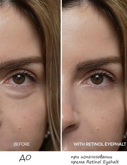Крем под глаза для мгновенного лифтинга с ретинолом «Retinol Eyebag Cream»